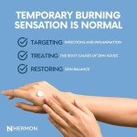 Antifungal Cream for Jock Itch, Psoriasis, Ringworm