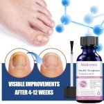 Extra Strength Toenail Fungus Antifungal Cream