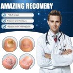 Extra Strength Toenail Fungus Antifungal Cream