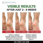 Clotrimazole Antifungal Cream for Skin Relief