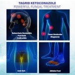 Ketoconazole Cream for Seborrheic Dermatitis Relief