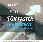 Ketoconazole Cream for Seborrheic Dermatitis Relief