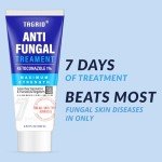 Ketoconazole Cream for Seborrheic Dermatitis Relief