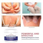 Extra Strength Antifungal Cream for Itchy Skin