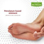 Medline Remedy Antifungal Ointment, 2.5 oz