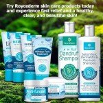 Roycederm Extra Strength Athlete’s Foot Treatment Cream