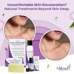 Naturasil Tinea Versicolor Antifungal Lotion - 113g