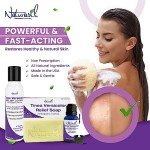 Naturasil Tinea Versicolor Antifungal Lotion - 113g