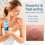 Roycederm Anti-Fungal Skin Cream for Tinea & Ringworm