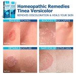 Roycederm Anti-Fungal Skin Cream for Tinea & Ringworm