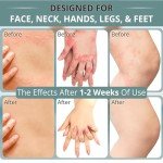 Raitera Extra Strength Natural Antifungal Cream 7oz