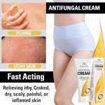 Extra Strength Antifungal Cream for Skin Relief