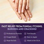 V20 Vite Antifungal Cream for Nails and Skin