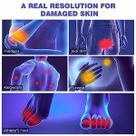 Extra Strength Jock Itch Cream for Men & Women