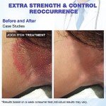Extra Strength Jock Itch Cream for Men & Women