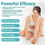 Maximum Strength Athlete's Foot Treatment Cream (2-Pack)