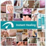 Maximum Strength Athlete's Foot Treatment Cream (2-Pack)