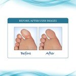 Funginix AF Athlete's Foot Cream - 2 Tubes