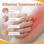 Ishancare Antifungal Cream for Tinea and Itching