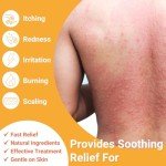 Ishancare Antifungal Cream for Tinea and Itching