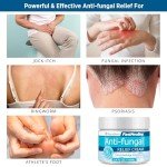 RoyceDerm Antifungal Cream for Skin Irritations