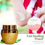 Skin Healing Cream with Aloe Vera & Crocodile Oil