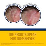 O'Keeffe's Itch Relief Body Cream - 8 oz