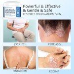 Soothing Itch Relief Cream for Foot & Body