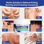 Charmpoo Anti-Itch Cream for Athletes Foot & Jock Itch 100g