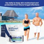 Charmpoo Anti-Itch Cream for Athletes Foot & Jock Itch 100g