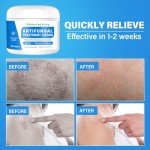 Athlete's Foot Relief Itch Cream for All Skin