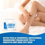 Athlete's Foot Relief Itch Cream for All Skin