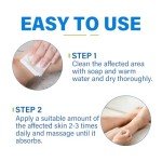 Athlete's Foot Relief Itch Cream for All Skin