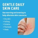 Execalm Cream - Soothing Relief for Eczema & Itching