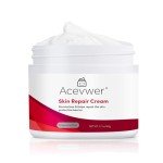 Itch Relief Cream for Skin Irritation - 1.7 oz