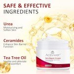 Itch Relief Cream for Skin Irritation - 1.7 oz