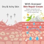 Itch Relief Cream for Skin Irritation - 1.7 oz