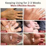 Itch Relief Cream for Skin Irritation - 1.7 oz