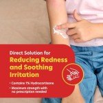 Maximum Strength Anti-Itch Cream with Aloe Vera