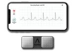 KardiaMobile ECG Monitor - Home AFib Detection