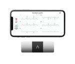 KardiaMobile 6-Lead ECG Heart Rate Monitor