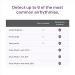 KardiaMobile ECG Monitor: Wallet-Sized Heart Tracker