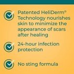 Neosporin Antibiotic Ointment for Minor Wounds 0.5 oz