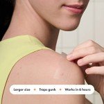 Mighty Patch Surface - Hydrocolloid Spot Patches (10 Count)