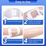 100 Pcs Waterproof Transparent Film Dressings