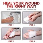 HEALQU Sterile Bordered Gauze Dressing - 50 Count