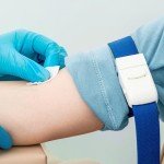 Alcohol Prep Pads, 70% Isopropyl, 200 Count