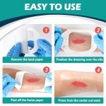 Clear Waterproof Film Dressing - 4" x 5", 30 Pack