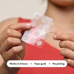 Mighty Patch™ Original Hydrocolloid Acne Pimple Patches