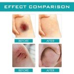 Transparent Quick-Dry Waterproof Liquid Bandage Spray